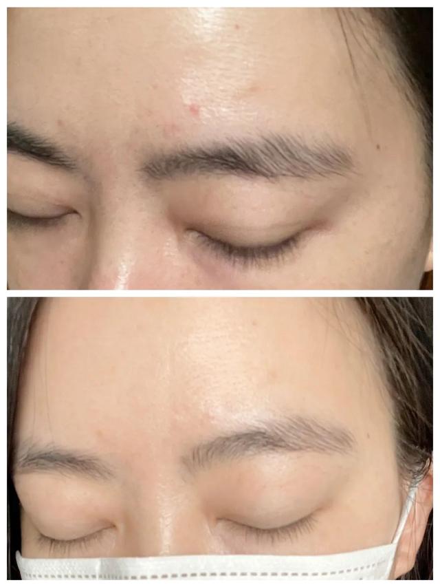 酵素 海报试用｜整天嚷嚷着要白，今天终于安排上了...