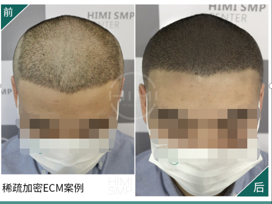 沙奎尔·奥尼尔 奥尼尔晒新发型！板寸加精修发际线，像极了纹发！