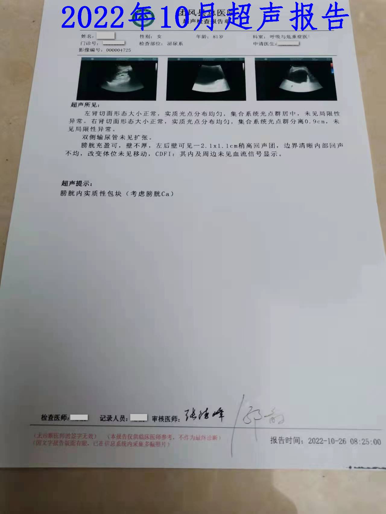 猪肉|膀胱肿瘤不手术,只吃中药行不行?