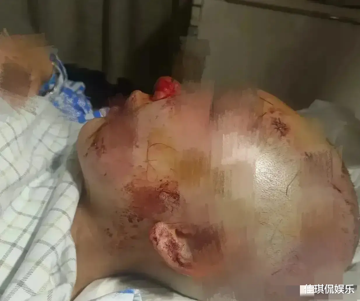 必须曝光!花季少女,被流氓殴打致面目全非!差点将女孩打死!