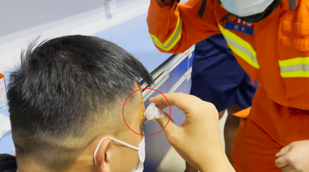 医生|看着都疼！男子夜钓鱼钩扎进前额……