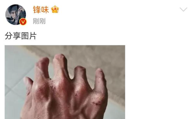 谢霆锋|谢霆锋拍戏有多拼？一只形如枯爪，还满带伤痕的手就是最好证明！