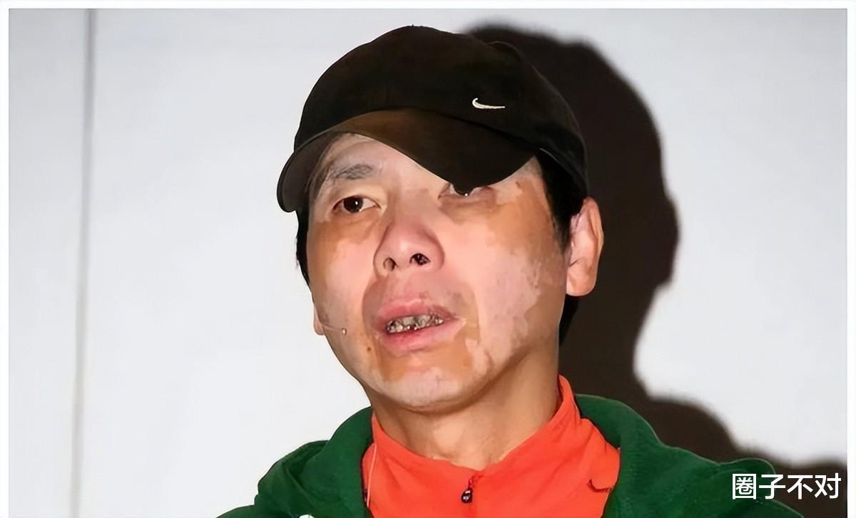 黄瑜娴|口水能过敏，天生没子宫，这6位明星的“隐疾”，有钱也治不好