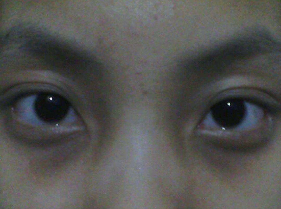 bmi|屁多是肝脏发生病变了吗？提醒：身体出现1臭2黑的情况，别忽视