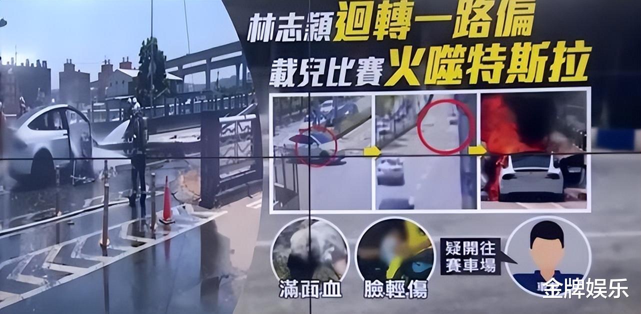 香港|林志颖手术方案出炉:钛合金固定颜面骨,脸型恢复原样可能性很高