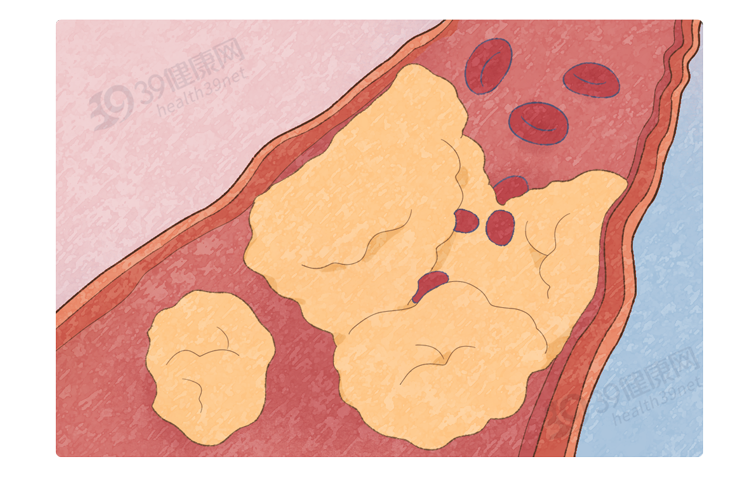鸡蛋|浙大研究:每天多吃半个蛋,癌症和心脏病死亡风险会增加?可信吗