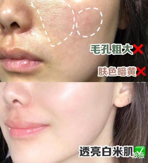 护肤品 因包装丑被“打入冷宫”的护肤品,在日本卖出“天价”,资生堂地位不保