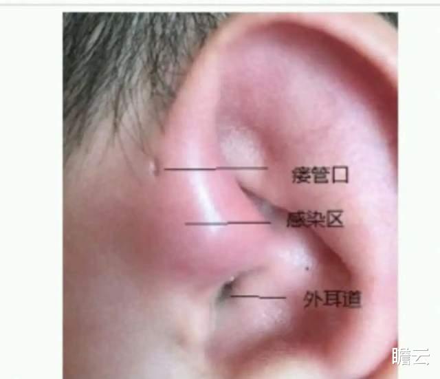 人类中耳由鱼鳃进化而来被石锤,还有哪些器官是鱼鳃进化来的?