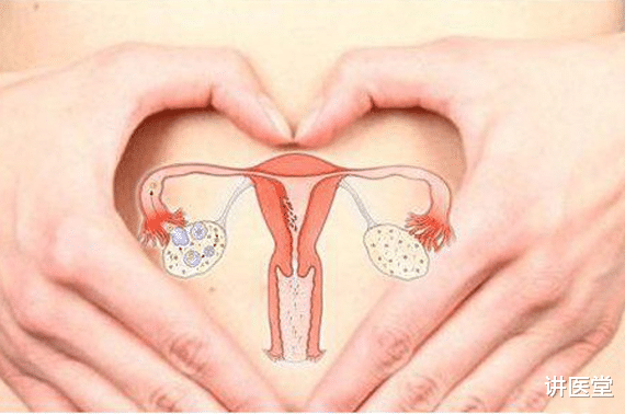 穴位|“我挑战多囊卵巢的经历，已初有成效，信心满满”