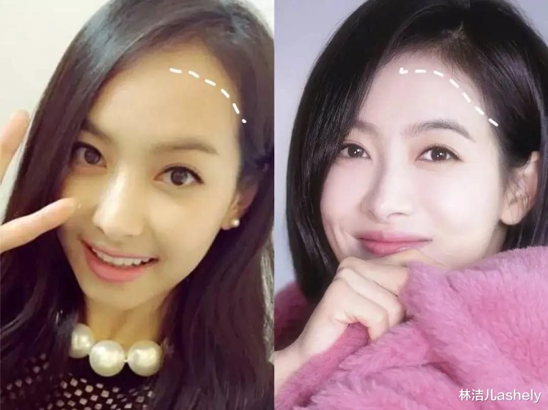 发际线|听说发际线能改变命运?宋茜、赵丽颖稍稍一改变,立刻颜值飙升了