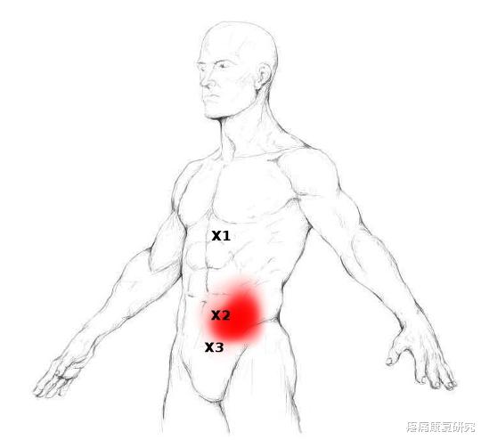 臀部|臀部疼痛可能是腹直肌在捣乱