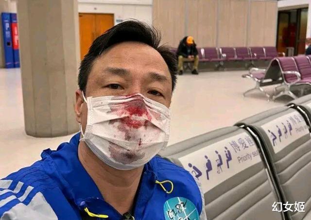 王喜|知名演员做核酸被捅伤,网友却不同情,曾参演《风云雄霸天下》