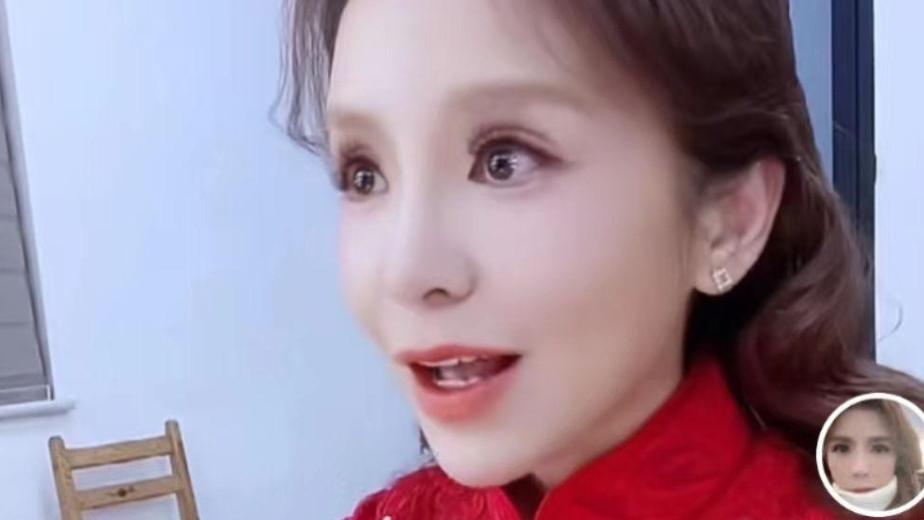 朱迅|49岁朱迅近照认不出，眼窝凹陷眼睛大得离谱，曾患癌症无缘春晚