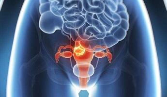 卵巢|女人雌性激素不足,做好1事,少做6事,多吃三物,养好卵巢显年轻