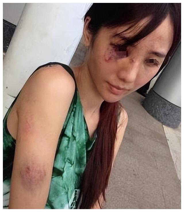 宋汶霏|演员宋汶霏：开豪车住豪宅，27岁离世，离世前她的选择让人泪目