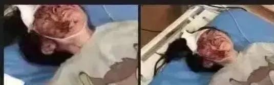 巷子视频曝光!证据显示伤者还活着,伤口触目惊心,网暴女儿升级