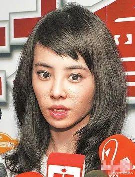 生图|精修是神颜,生图满脸痘,痘坑、黑眼圈、长斑,明星没那么美