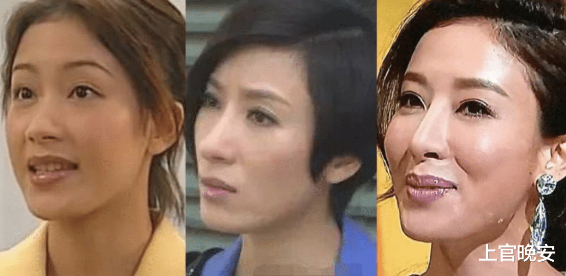 娱乐圈|娱乐圈明星们的假鼻子，真的绝了！都是狠人