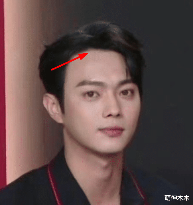 许凯|27岁许凯快秃了，发际线神似杨幂，二人合作偶像剧有望9月空降