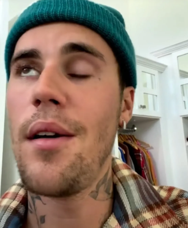 贾斯汀·比伯|比伯患上面瘫,右边脸无法动弹,眼皮无法眨动,宣布推迟世界巡演