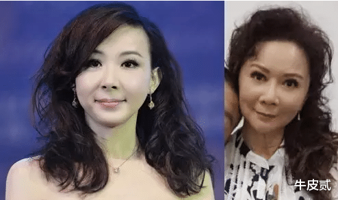 姐姐|明明“优雅自然”,却偏要“硅胶脸”的5大女星,个个苦不堪言