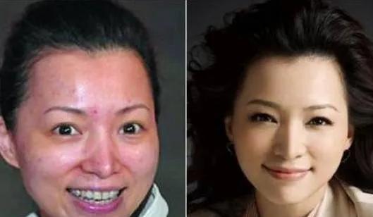 连衣裙 普通人如何快速提升颜值?3个方法很实用,效果看得见