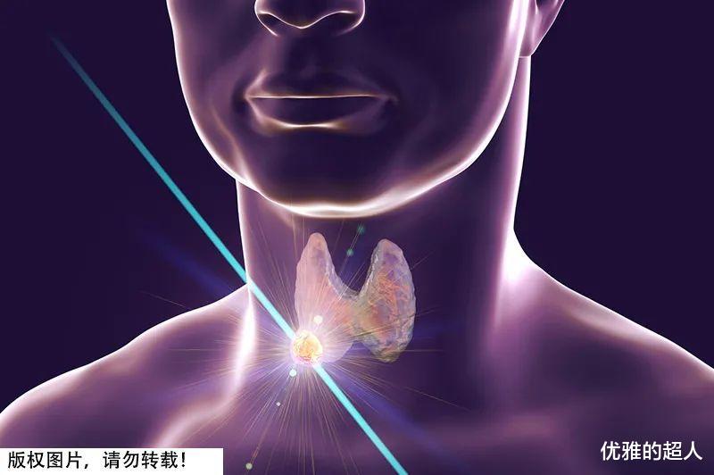 体检|体检发现结节,真的“难逃一劫”吗