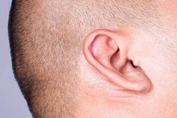 运动|血脂升高,脸上常有三种表现,做好三件事,迅速清理血管垃圾