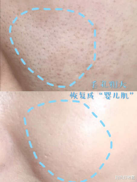 迪丽热巴 热巴原来也是“照骗”！外媒镜头下毛孔显而易见，看上去超尴尬