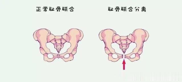 护肤 石原里美产后15天复出，产后瘦身如何做？2步赶走大肚子妈妈臀