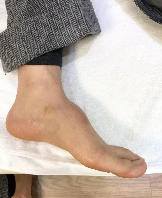 谢霆锋|谢霆锋的手，黄晓明的脚！娱乐圈没有哪个巨星，可以随便成功