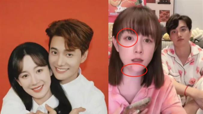 张檬|张檬因过年不想回韩国与小五打了架，脸上挂彩还直播，网友：剧本