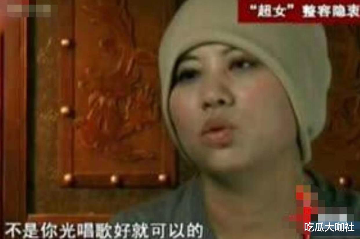 整容|10位整容毁掉的女星：有人自己注射食用油，有人上瘾，有人丢了命