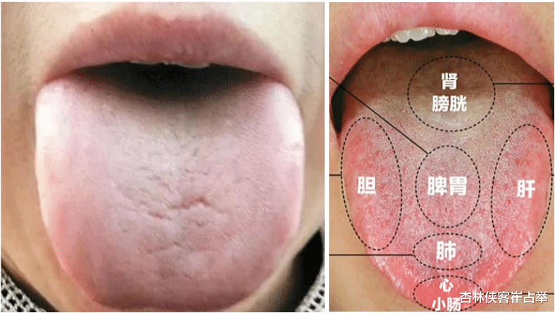 新型冠状肺炎|体质弱、抵抗力差易生病，中医教你一招，让你提高免疫力！