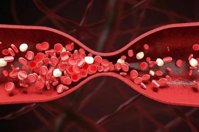 更年期|“血栓大户”被揪出,医生建议管住嘴,别等生病了才着急