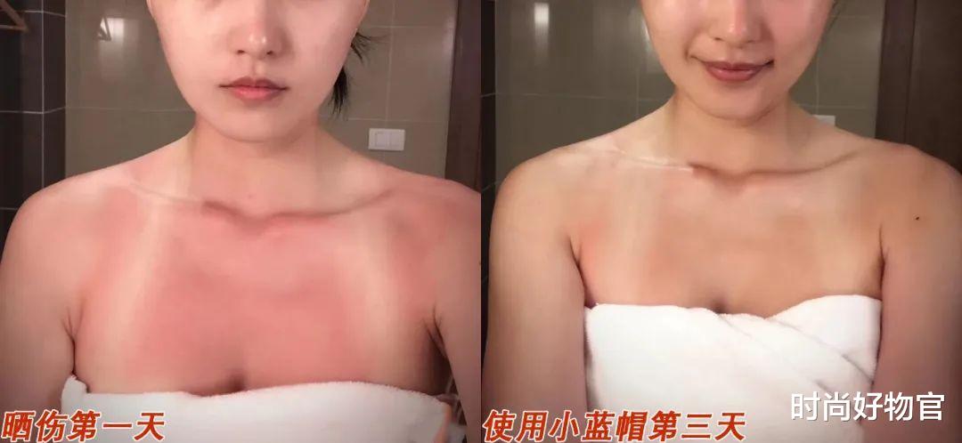 防晒|张含韵从不晒太阳,黄圣依从不擦防晒,二人手上的差距有多明显?