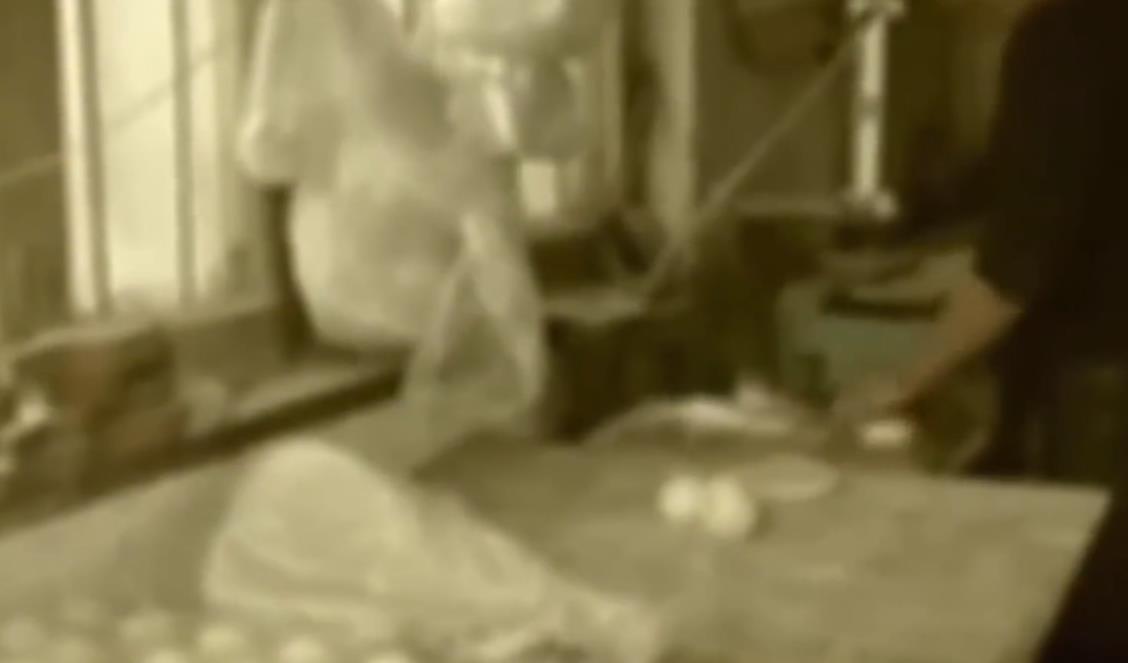 6个月的孕妇被烧焦,胎儿还活着,她以命换命扯掉焦死皮生产