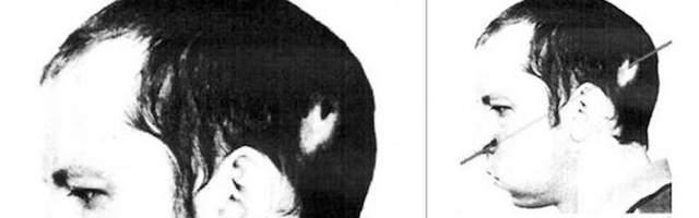 他把头伸进高能粒子加速器,被接近光速的粒子爆头,结果怎样了?