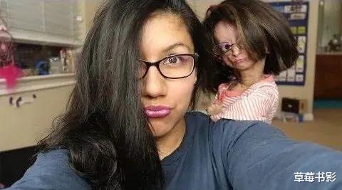 早衰症|患早衰症15岁千万粉丝少女博主逝世，粉丝：她终于不再痛苦了