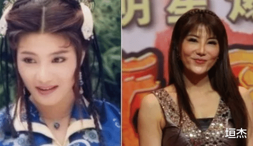 整容|7位“整容塌房”的女星，不说名字，你还能认出来吗？