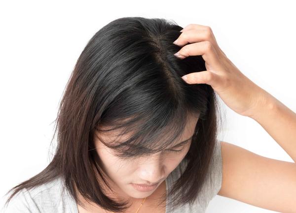 头皮屑 天天洗头发，为何头皮屑还是很多？和洗发水有关？留意四点原因