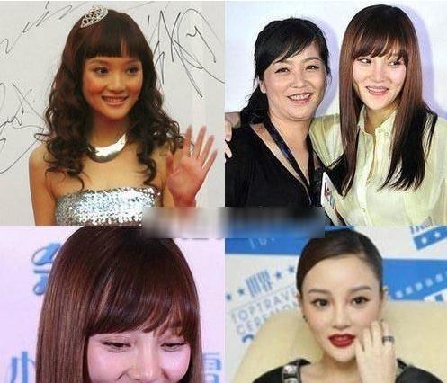 杨幂|从“大饼脸变成小V脸”的9位明星，杨幂说整了牙，金晨死鸭子嘴硬