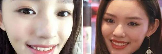 明星 明星常用好物：黄晓明的发套，鞠婧祎的肩垫，还有薛之谦的鞋垫
