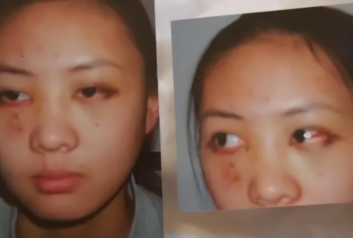 童瑶|童瑶素颜喝酒肿到快认不出，拿电子烟与男性调笑，富豪老公疑在旁