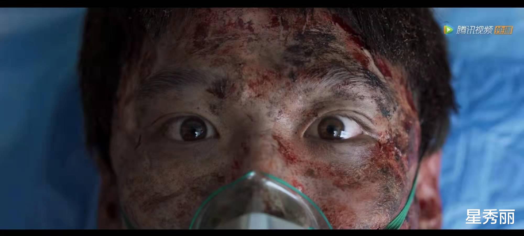 开端|《开端》这逼真的炸伤妆，第一眼你绝对认不出这是白敬亭