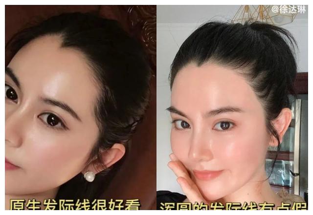 发际线|朴敏英新剧《月水金火木土》,这个发际线好像戴了个假头套?