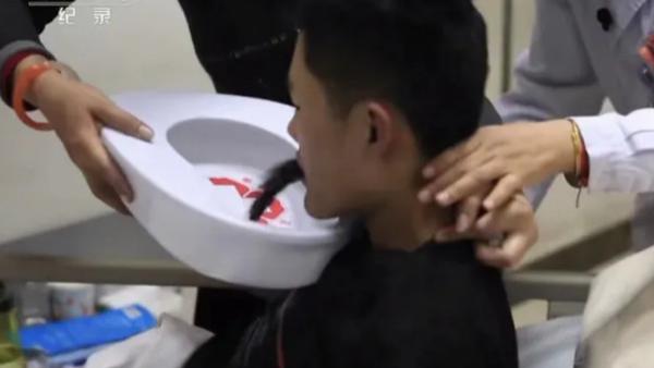 小伙喝百草枯，治疗18天后能吃能说话，医生却暗示准备后事