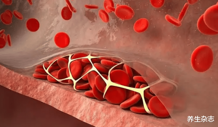 |胆固醇“大户”被揪出,蛋黄排末尾,医生:你若爱吃,铁打的血管也难扛