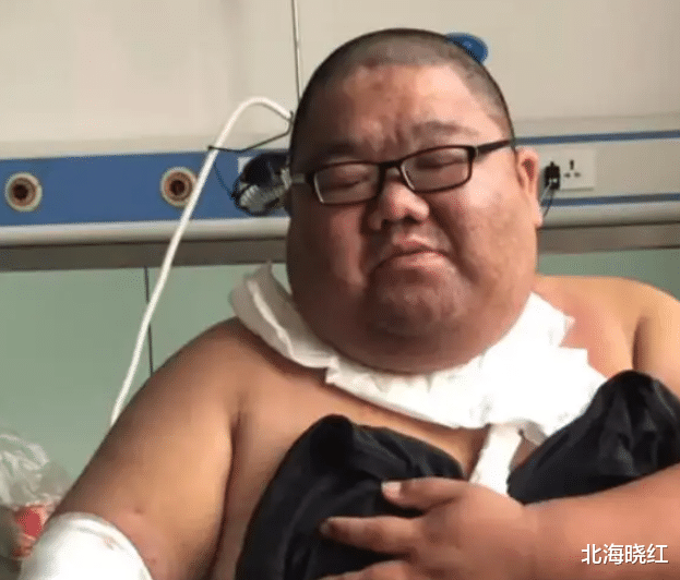 护肤 吃播“四巨头”两年去世俩，胖猴仔惜命减200斤，恩克端盆不停吃