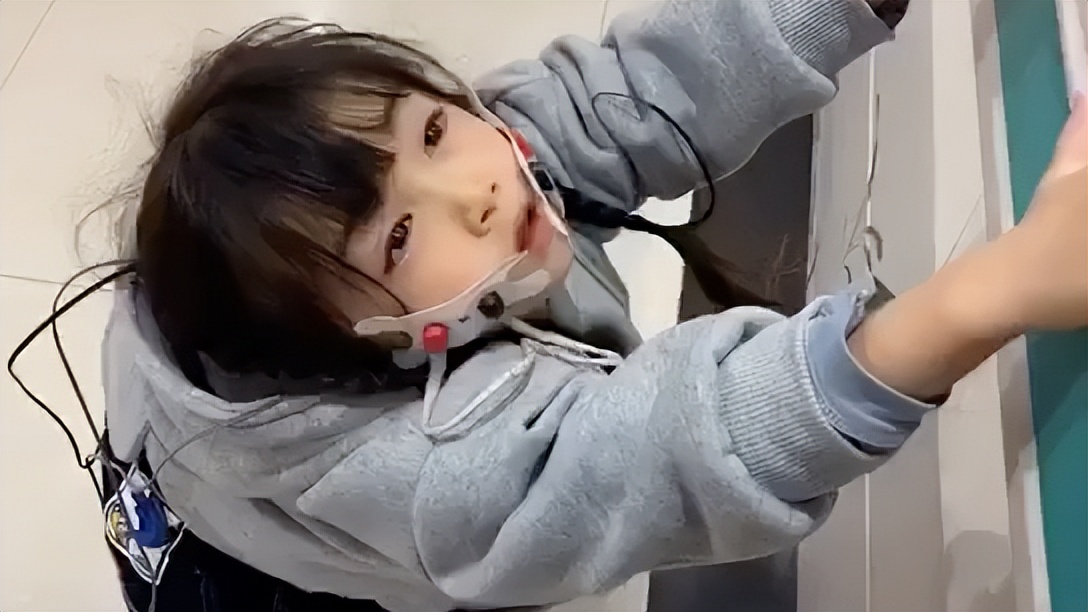 女孩|“无声芭比”蓝妮妮：漂亮脸蛋却患上怪病，爸妈不离不弃引争议